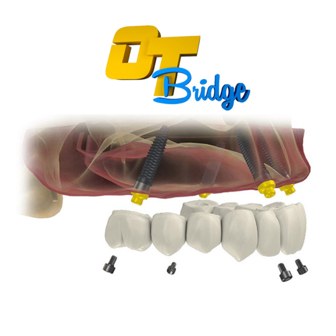 Ot Bridge