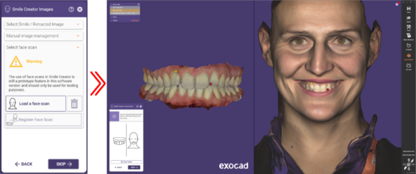 Poznasz wszystkie etapy przygotowania stanowiska do pracy z drukarką 3D – od instalacji i konfiguracji oprogramowania ChituBox lub dedykowanego dla Twojej drukarki, po drukowanie i postprocessing modeli protetycznych. Dzięki temu zyskasz pełną kontrolę nad procesem druku, co przełoży się na wyższą jakość Twoich prac.