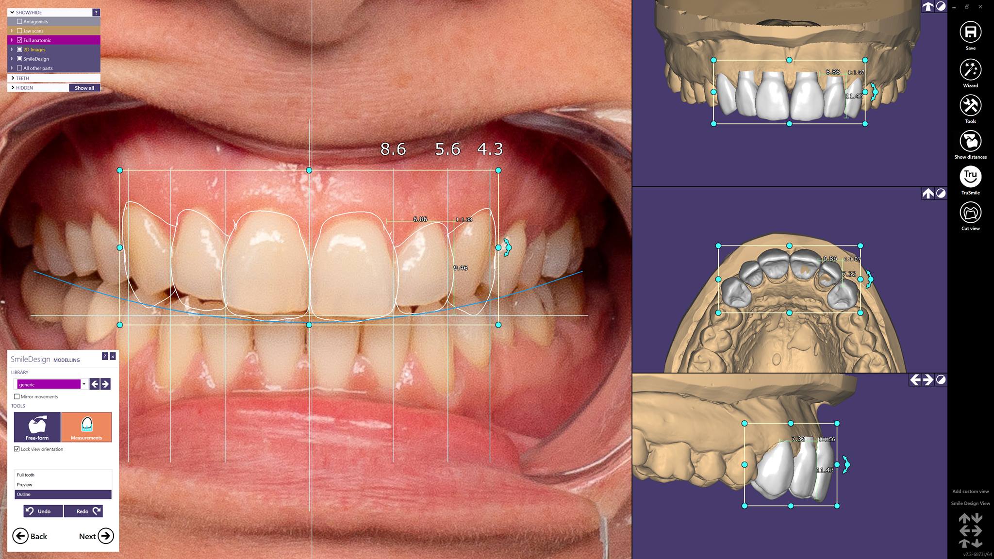 Exocad Druk3d Model Creator