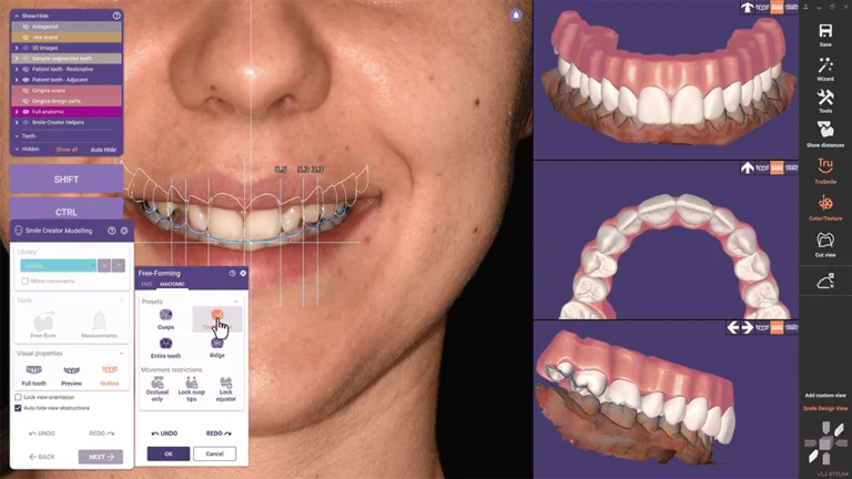 exocad_DentalCAD_Elefsina_Features_2_Smile_Creator_03